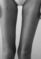 Dangereuse mode chez certaines adolescentes: le thigh gap