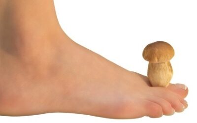 Le pied d&rsquo;athlète