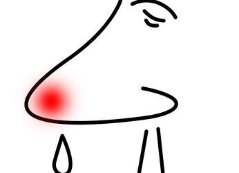 Un filtre nasal pour traiter les allergies aux pollens