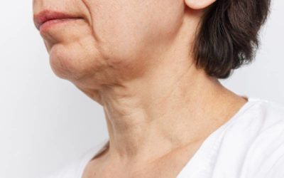 L&rsquo;héliodermie ou vieillissement cutané lié au soleil