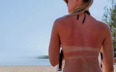 Pourquoi faut-il s’exposer au soleil avec précautions