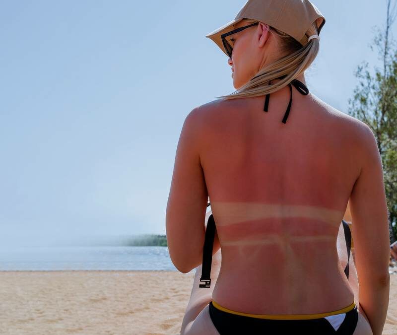 Pourquoi faut-il s’exposer au soleil avec précautions