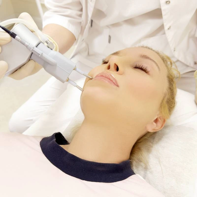 Séance de traitement au laser dermatologique du visage réalisée en cabinet médical