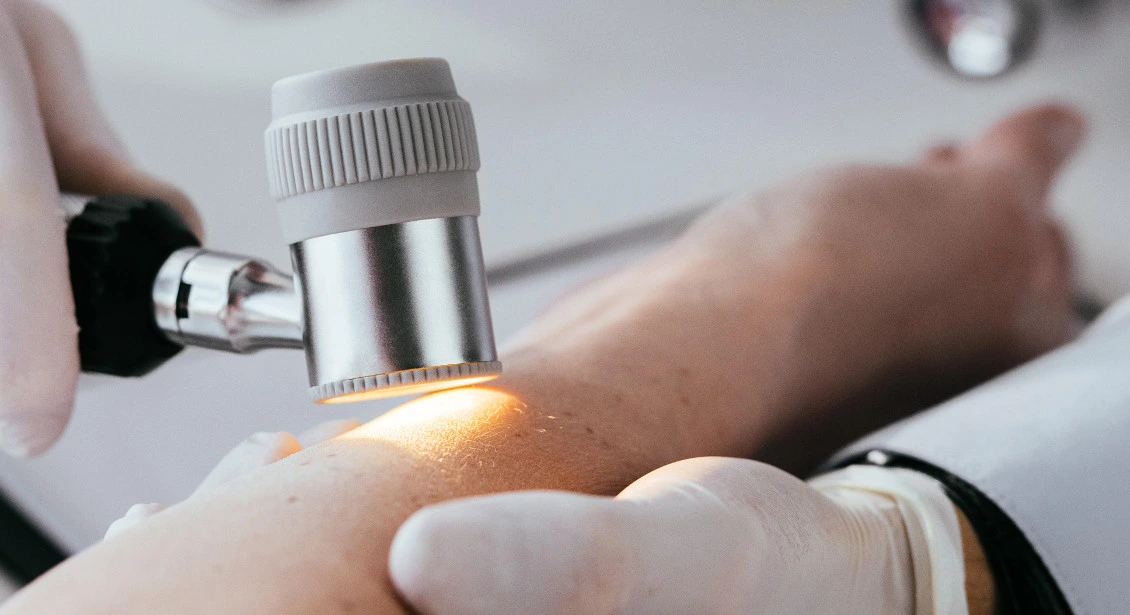Consultation en dermatologie esthétique et laser à Paris