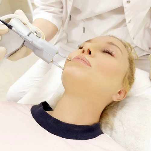 Traitement de laser dermatologique pour améliorer la qualité de peau et les signes du vieillissement