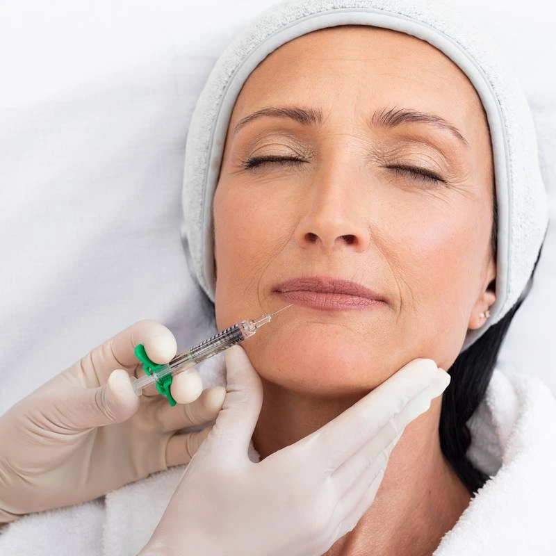 Résultat naturel après injection d’acide hyaluronique du visage à Paris