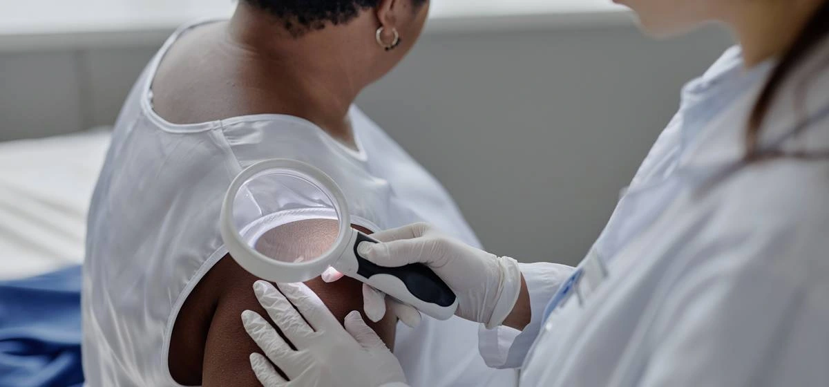 traitement dermatologique des peaux noires et métissées en cabinet à Parisabinet à Parisge