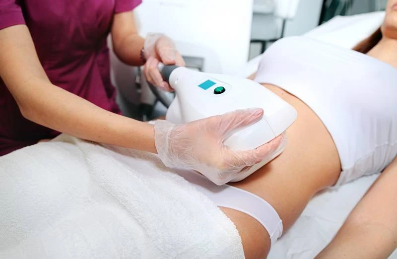 Traitement de cryolipolyse réalisé pour réduire les bourrelets localisés avant l'été